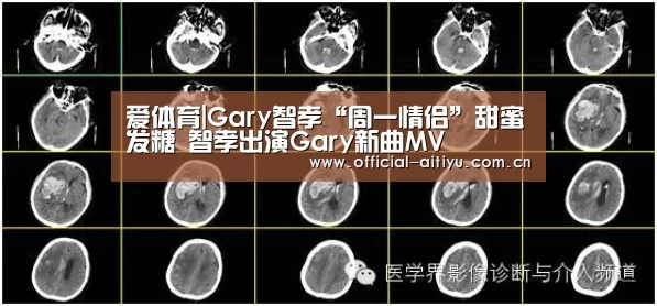 爱体育